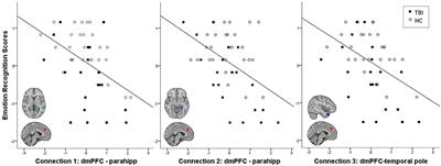 Default Mode Network Connectivity Predicts Emotion Recognition and Social Integration After Traumatic Brain Injury